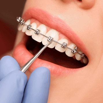 im-box-bnr_356x356_03